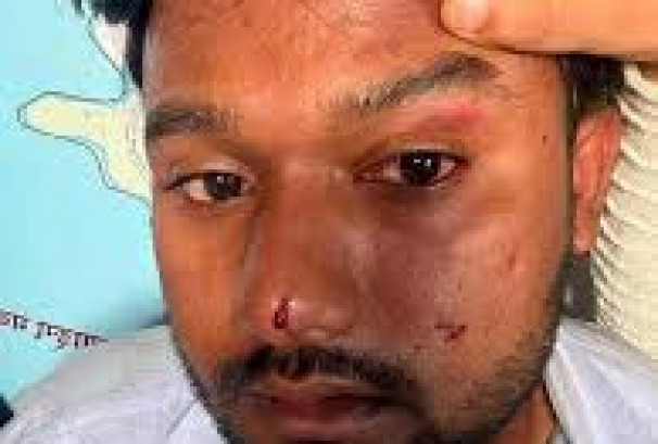 माजिद अन्सारीमाथि कुटपिट प्रकरणमा मानव अधिकार आयोगमा उजुरी