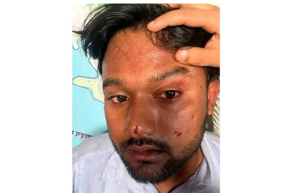 अस्पतालबाट जेनजी अभियन्ता माजिदको अपिल, ‘मेरो जीवन तथा व्यक्तिगत स्वतन्त्रताको सुरक्षा सुनिश्चित गरियोस्’